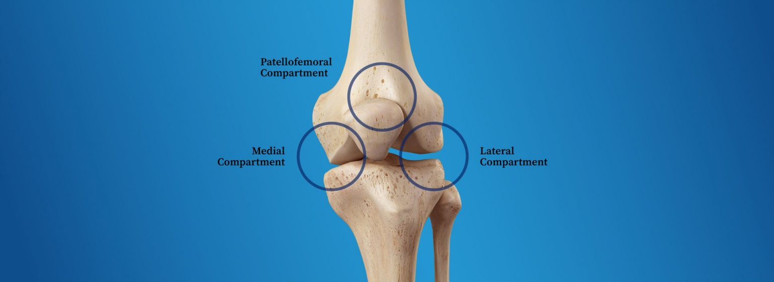 What is Osteoarthritis? Here’s What You Need To Know AposHealth® UK